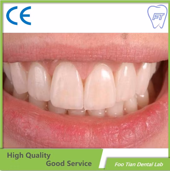 Стоматологическая лаборатория Циркониевая коронка и мост из Китая Стоматологическая лаборатория